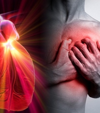 Komplikacionet kardiake pas një iktusi rrisin gjasat për ngjarje kardiovaskulare në të ardhmen